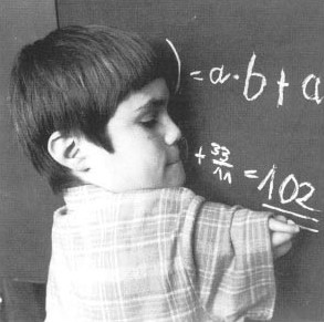 Thalidomide affected child with upper limb damage writing on a blackboard
