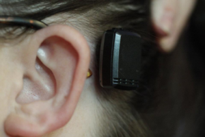 bone anchored hearing aid